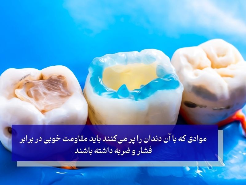 مواد پرکننده دندان