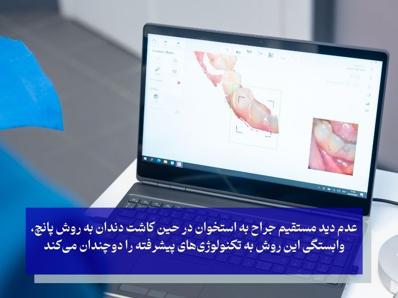 نقش تکنولوژی در موفقیت کاشت دندان به روش پانچ