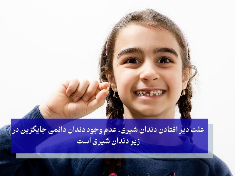نیفتادن دندان شیری تا بزرگسالی