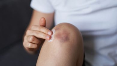 چه بیماری هایی باعث کبودی بدن ميشود؟