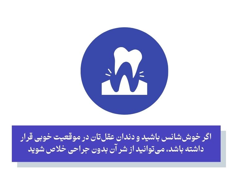 کشیدن دندان عقل بدون جراحی دقیقا یعنی چه