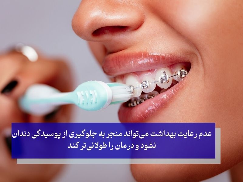 کلید طلایی ارتودنسی در زمان کوتاه