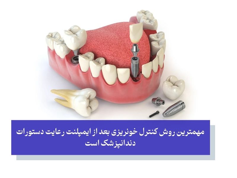 کلید موفقیت در بهبودی سریع