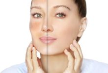 گلوتاتیون برای سفیدی پوست