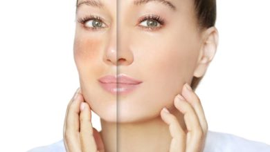 گلوتاتیون برای سفیدی پوست