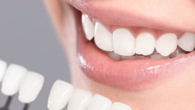 کامپوزیت شیشه ‌ای