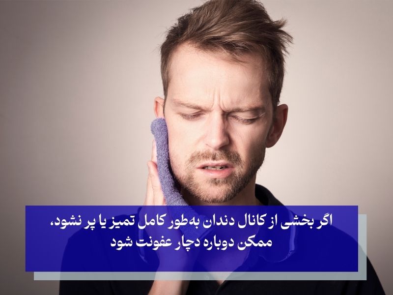 آیا درمان کانال ریشه عوارض دارد؟