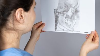 اختلال مفصل گیجگاهی فکی