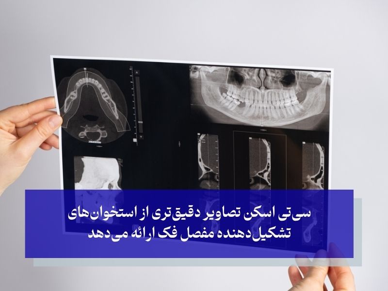 تشخیص اختلال مفصل گیجگاهی فکی