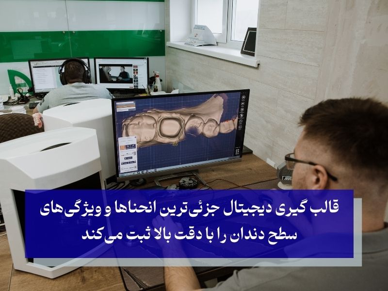 تصویربرداری دقیق با استفاده از اسکنر در قالب گیری دیجیتال