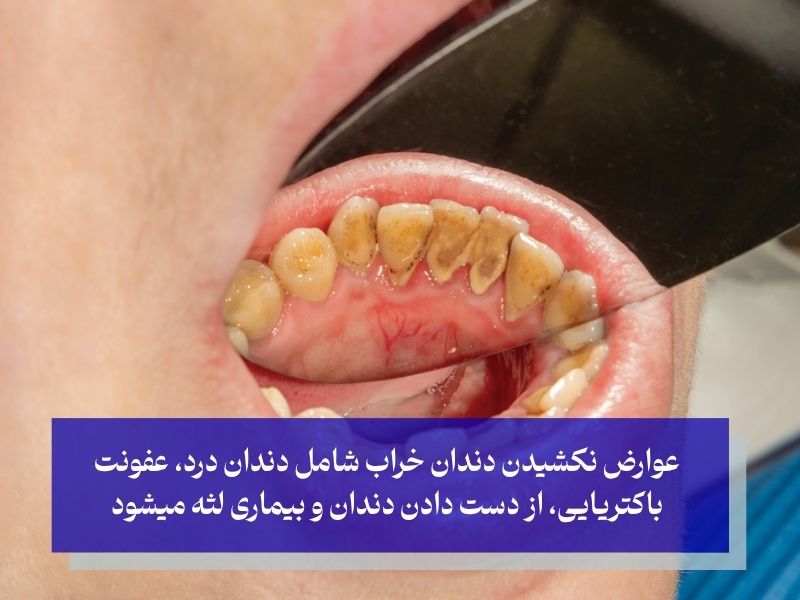 خطرات نکشیدن دندان خراب