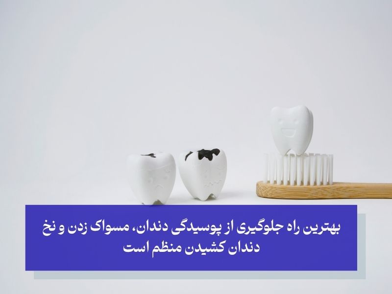 راه های جلوگیری از پوسیدگی دندان