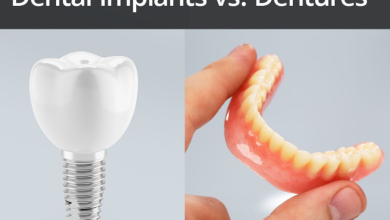 فرق ایمپلنت و دندان مصنوعی