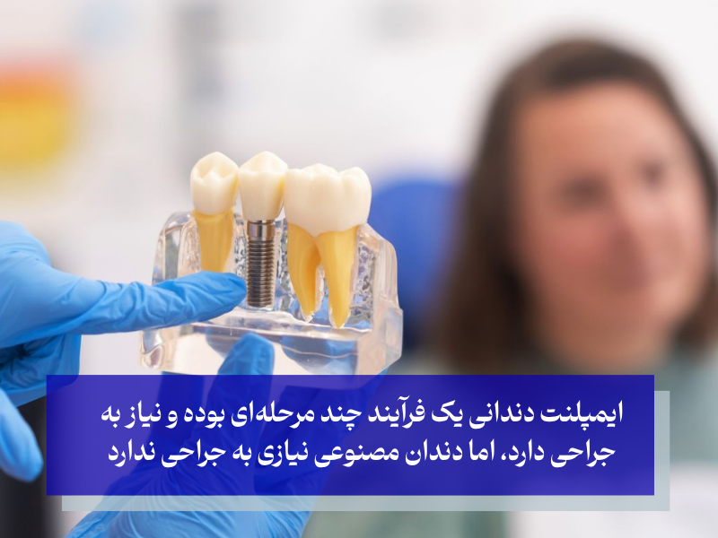 فرق ایمپلنت و دندان مصنوعی از نظر فرایند انجام 