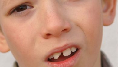 لب پر شدن دندان کودک