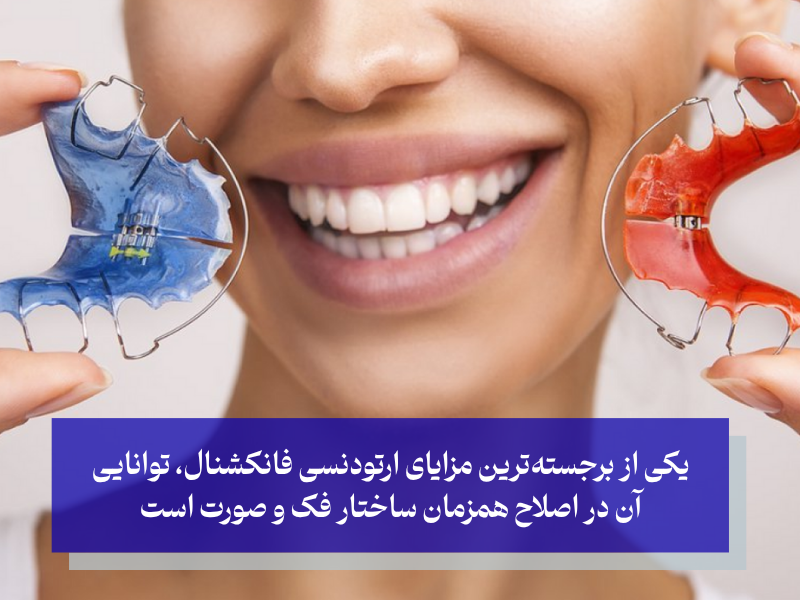 مزایای ارتودنسی فانکشنال
