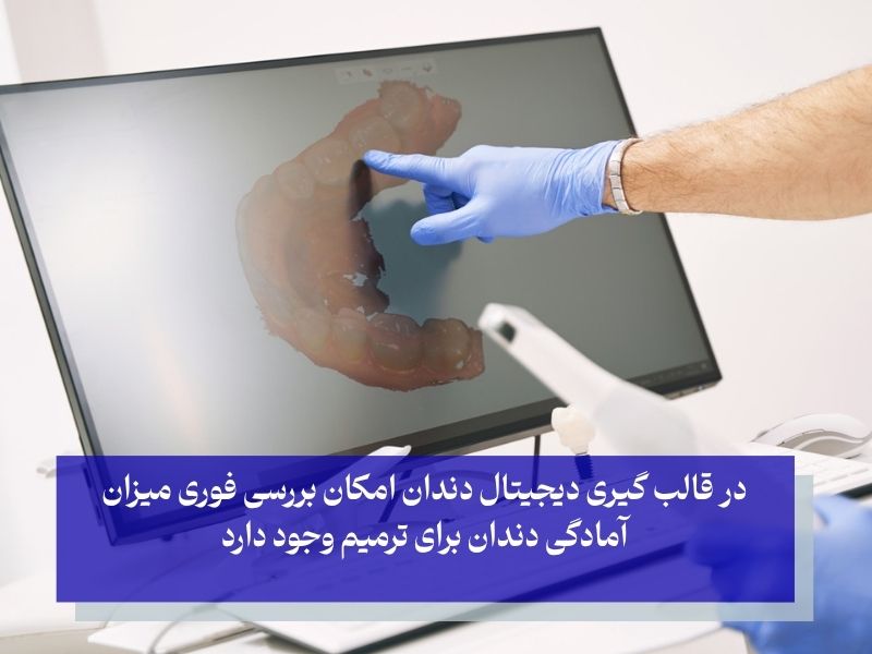 مزایای قالب گیری دیجیتال دندان