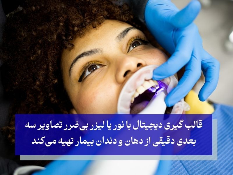 نحوه کار قالب گیری دیجیتال