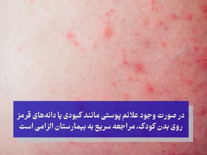 علائم و علت قطع نشدن تب در کودکان