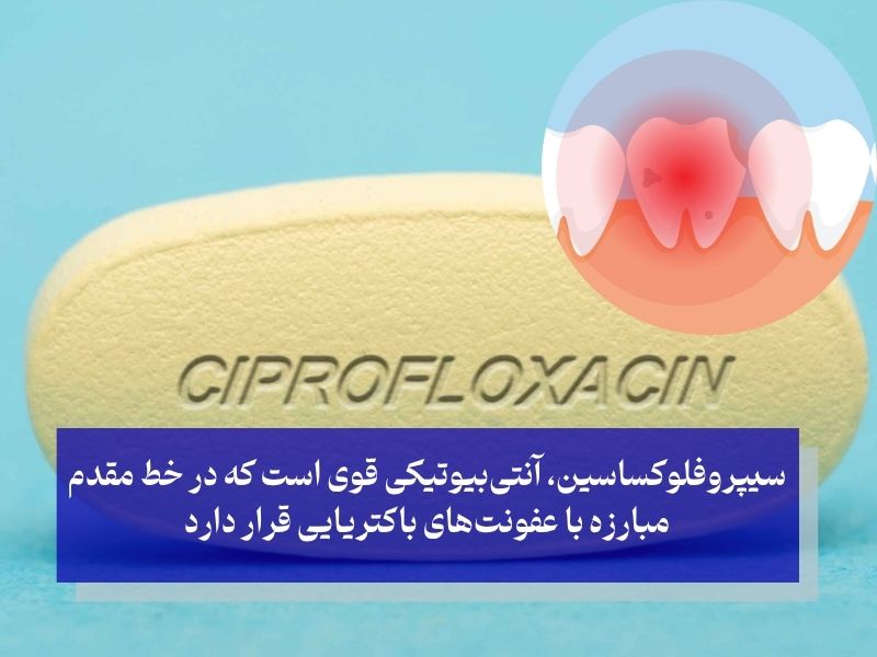آیا سیپروفلوکساسین برای عفونت دندان موثر است