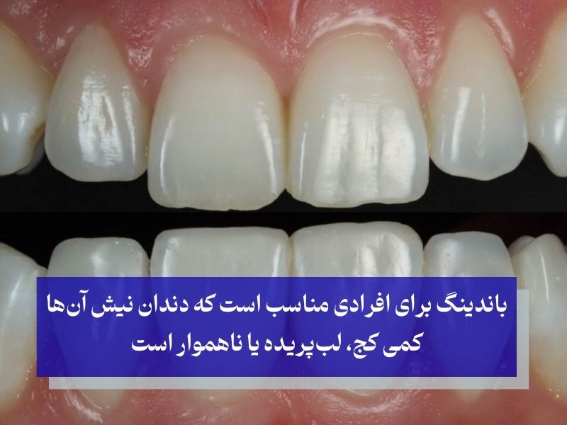 اصلاح سریع نیش‌های خفیف