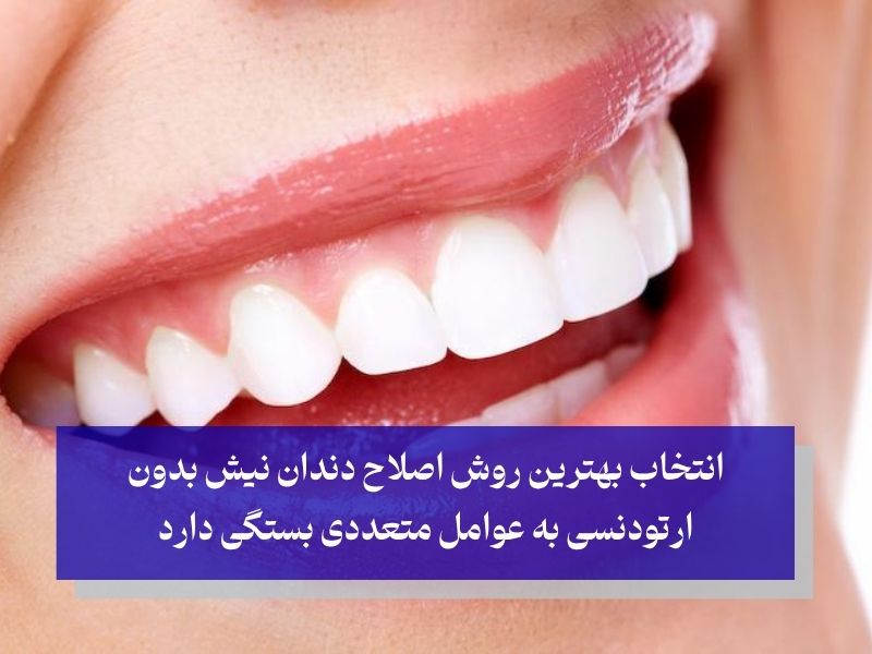 انتخاب بهترین روش اصلاح دندان نیش بدون ارتودنسی