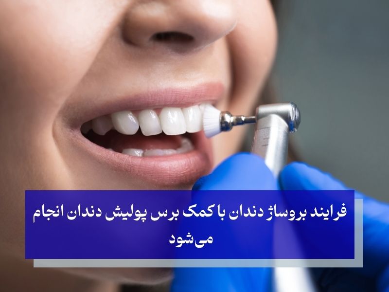 بروساژ دندان