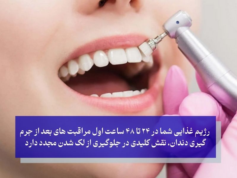 بعد از جرم گیری دندان چی بخوریم و چی نخوریم