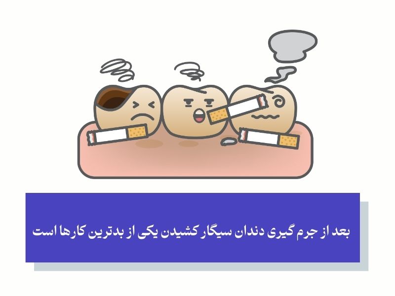 بهداشت دهان در مراقبت های بعد از جرمگیری دندان