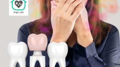 بوی بد دندان روکش شده