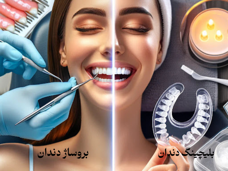 تفاوت بروساژ و بلیچینگ