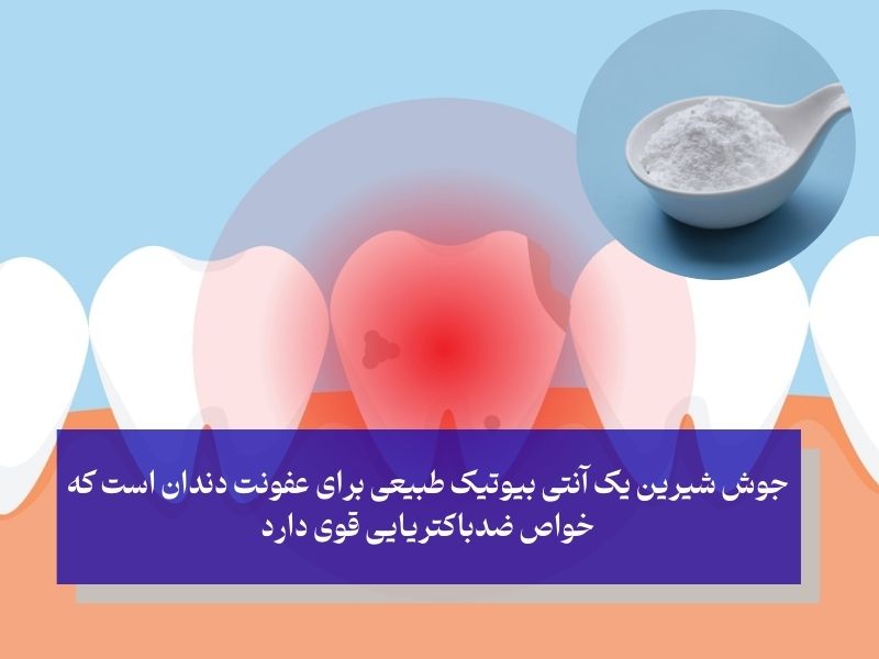 جوش شیرین برای عفونت دندان