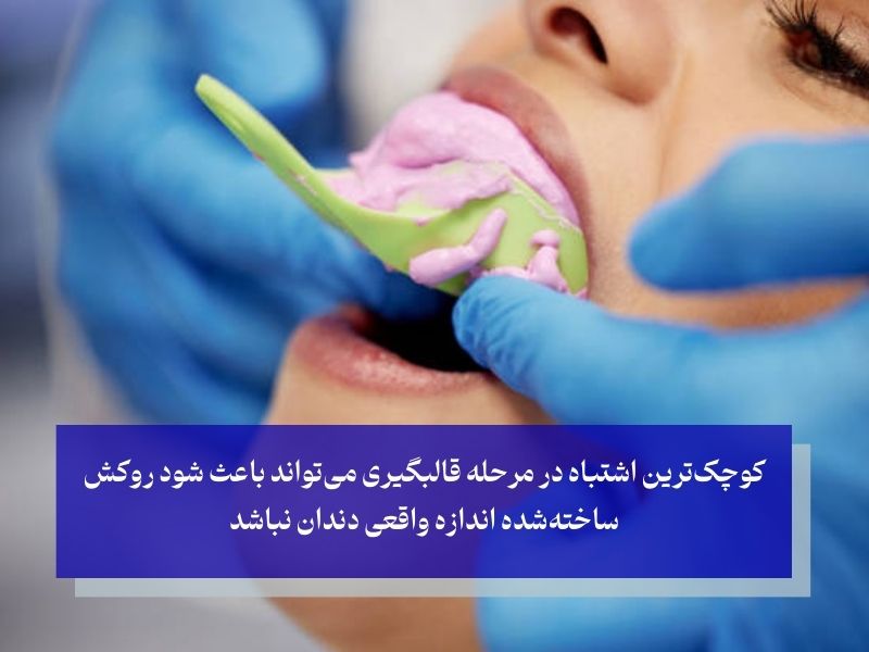 خطای دندانپزشک در قالب‌گیری