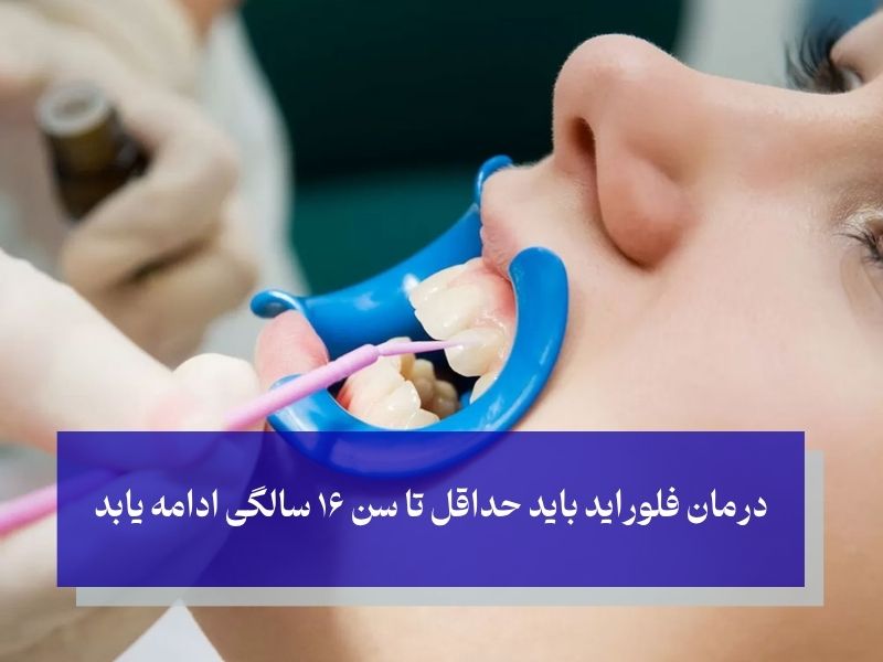 زمان درمان فلوراید تراپی کودکان
