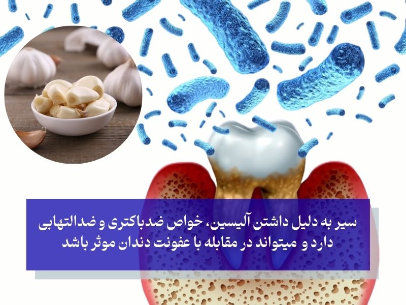 سیر برای عفونت دندان