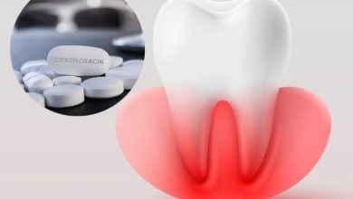 سیپروفلوکساسین برای عفونت دندان
