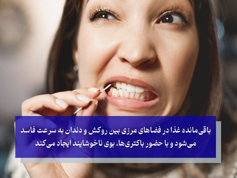 علت بوی بد بین دو دندان