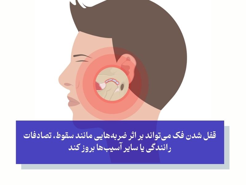 علل قفل شدن فک