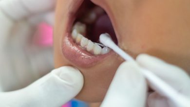 فلوراید تراپی کودکان