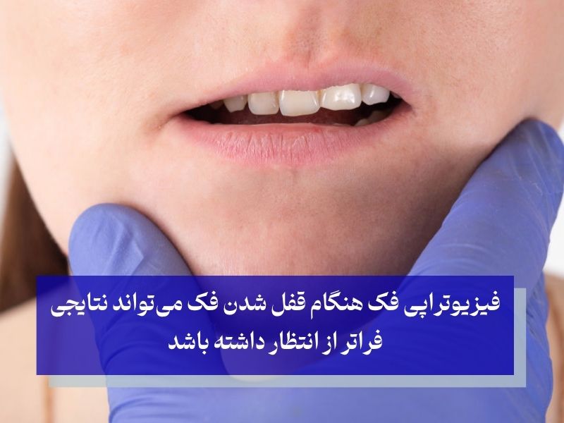 قفل شدن فک و فیزیوتراپی فک