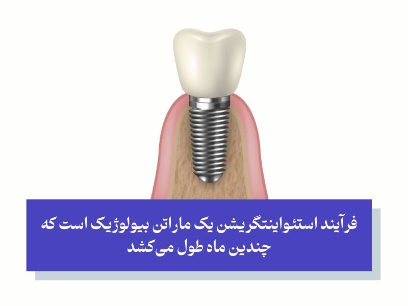 مراحل جوش خوردن استخوان فک با ایمپلنت