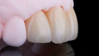 کوتاه و بلند بودن روکش دندان