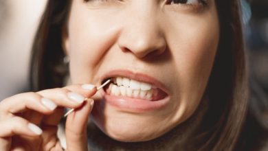 گیر غذایی دندان