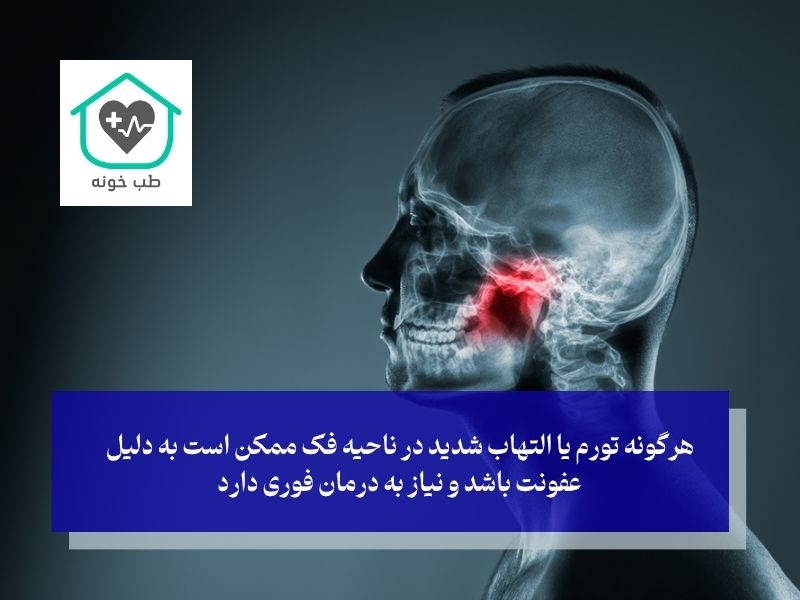 التهاب عامل درد فک