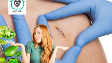 برای زود خوب شدن بخیه چه بخوریم