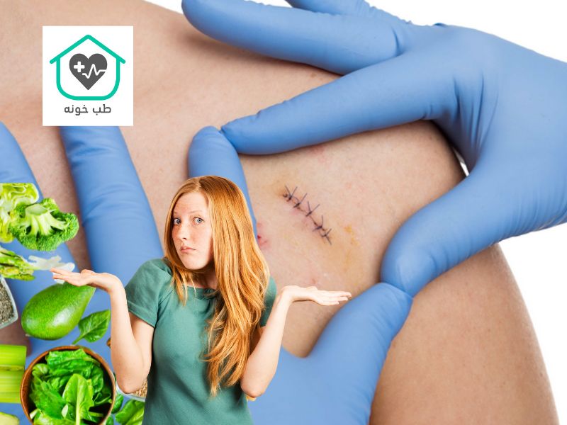 برای زود خوب شدن بخیه چه بخوریم