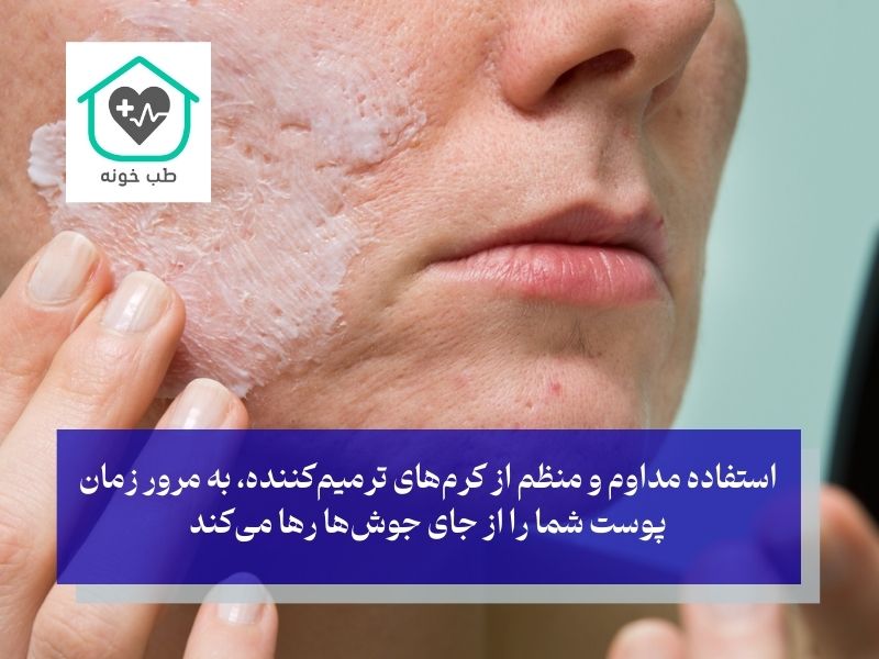 بهترین پماد برای جای جوش صورت