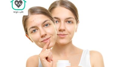 بهترین کرم ضد جوش و جای جوش