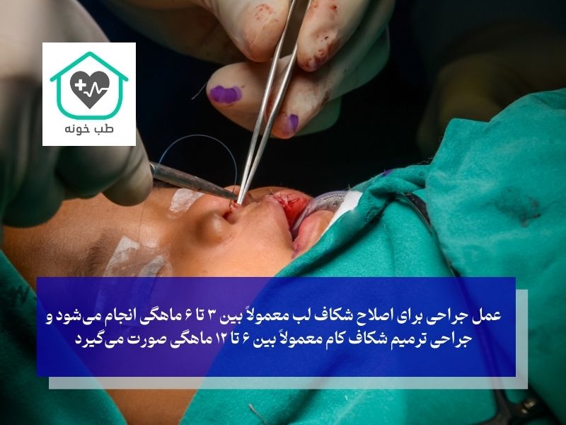 درمان شکاف کام و لب