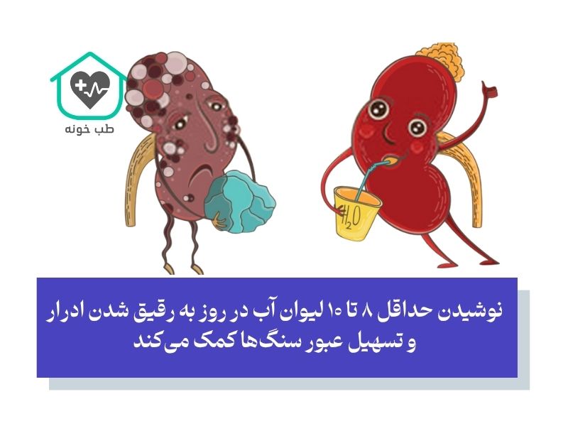 راهکارهای مؤثر برای دفع سنگ کلیه